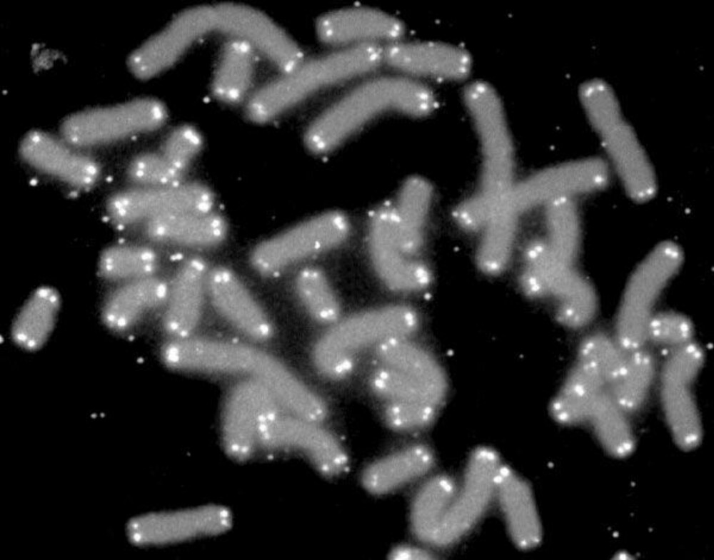 TELOMERENE: Menneskelige kromosomer i grått med det beskyttende lokket telomer i hvitt. TELOMERENE: Menneskelige kromosomer i grått med det beskyttende lokket telomer i hvitt.