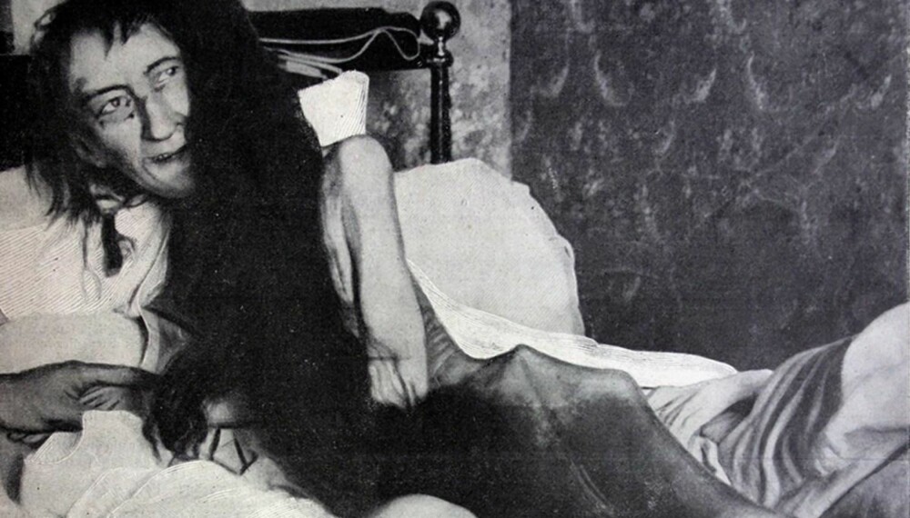 RADMAGER: Blanche Monnier, noen minutter etter hun ble funnet. RADMAGER: Blanche Monnier, noen minutter etter hun ble funnet.